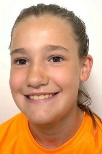 Nora Gimeno