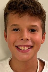 Ruben Albero
